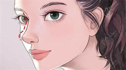 深圳鹏程整形医院郝立君医生介绍