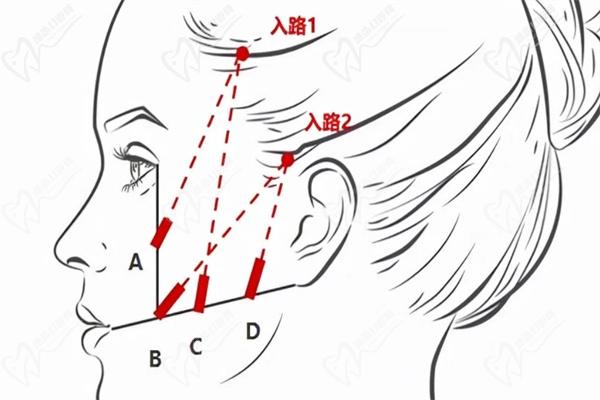张云卿——轮廓固定面部年轻派医生