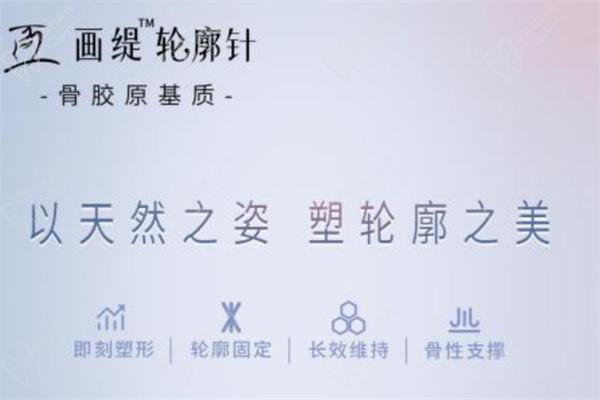 再生材料轮廓固定