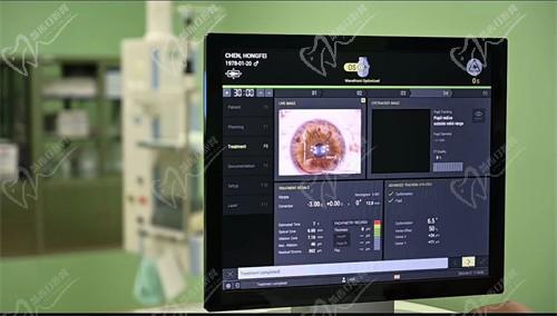 绍兴爱尔眼科李志强医生资质查询