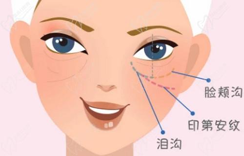 注射胶原蛋白哪个牌子的好