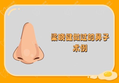 梁晓健做过的鼻子术例