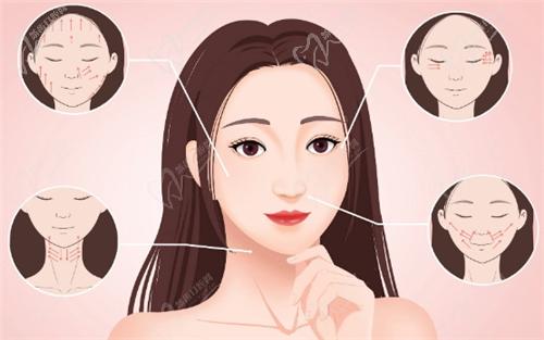 北京高明英注射的怎么样