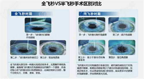 西安存 济眼科医院怎么样