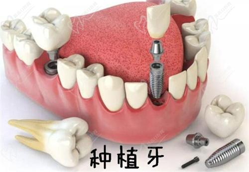 北京科尔口腔巩新科医生简介