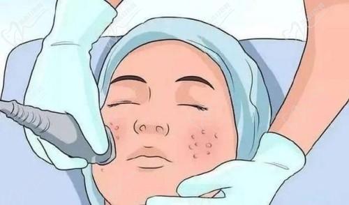 深圳博爱曙光整形医院特色项目 深圳博爱曙光整形医院特色项目