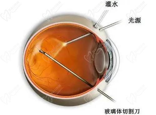 武汉艾格眼科医院彭志华医生的眼底病治疗技术高超