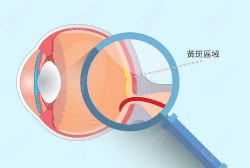 武汉艾格眼科医院彭志华医生技术扎实