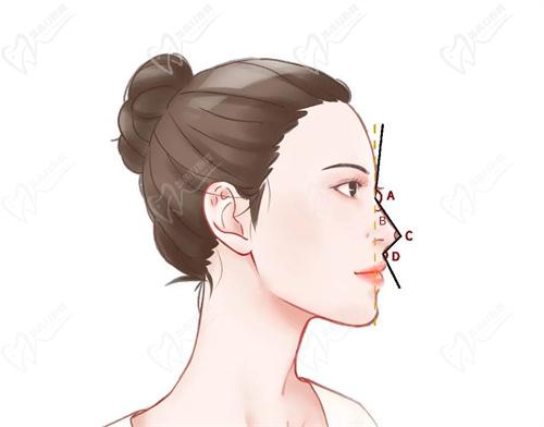 太原美媛荟冯瑞铮做鼻子真人实例