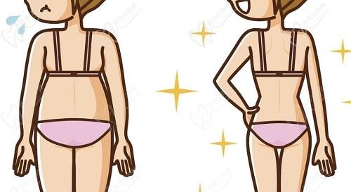 成都恒博天姿李烈吸脂