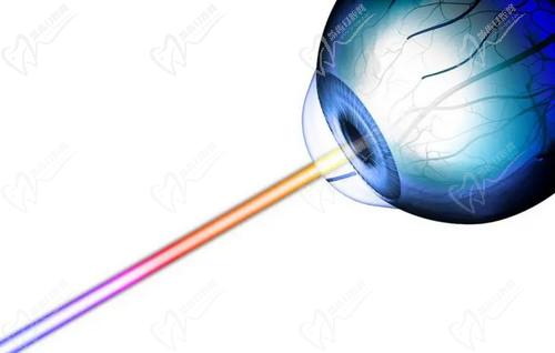 周跃明医生擅长做近视手术