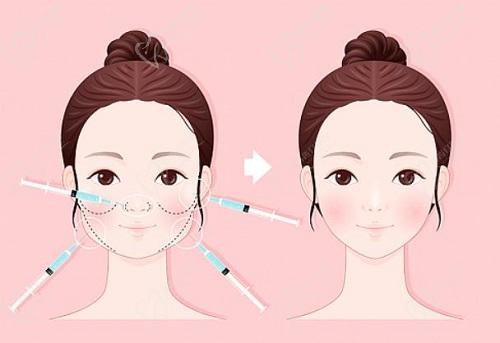 潘炯波擅长项目