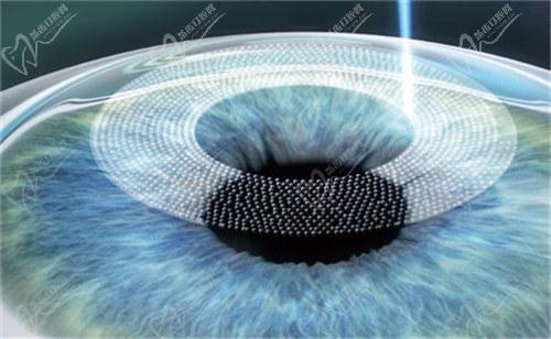 西安存 济眼科医院是一家正规的眼科医疗机构