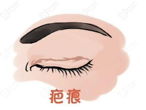 武汉同 济龚卫华医生眼修复技术扎实