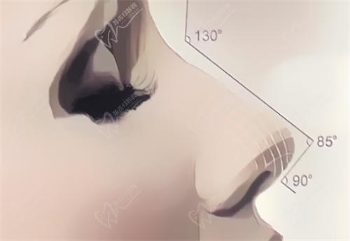 武汉同 济龚卫华医生隆鼻技术娴熟