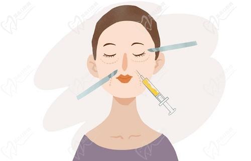 邯郸李婷医生做双眼皮怎么样