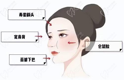 钟杰光修复馒化价格表