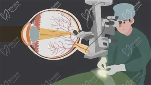 赤峰朝聚眼科医院上班时间与预约流程