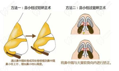 陈天杰医生收费价格