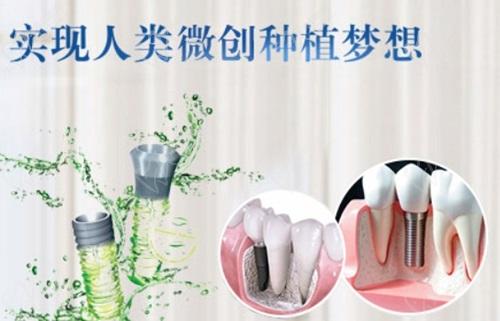 成都极光口腔医院种植牙怎么样？