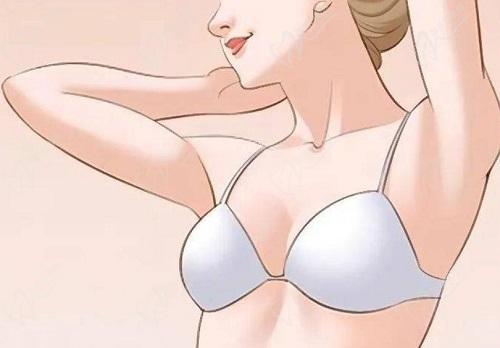 成都悦好陈国双隆胸