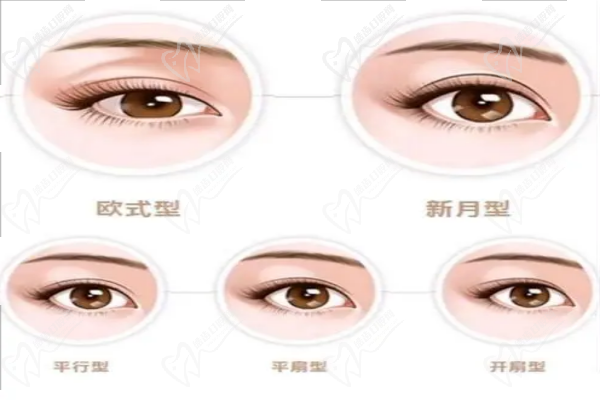 上海余东双眼皮修复怎么样