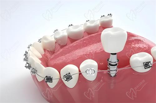 成都新桥口腔怎么样