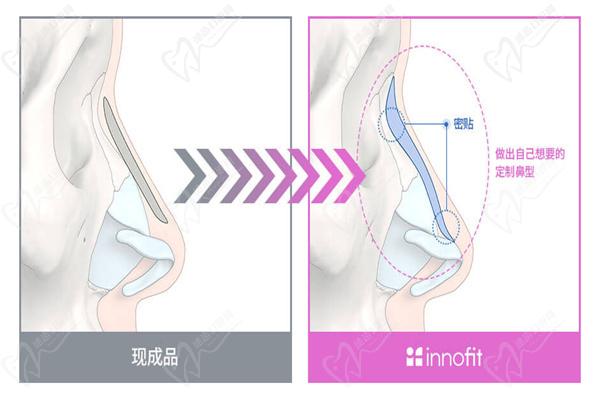 金载勋431鼻部案 例