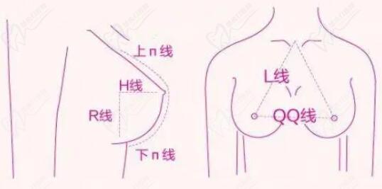 谭林医生自体脂肪丰胸手术的技术优势