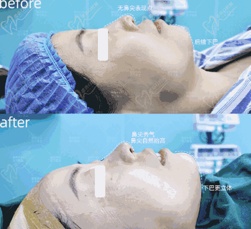 重庆党宁做鼻子怎么样