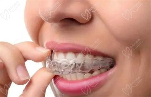 潘牛兵正畸医术怎么样啊