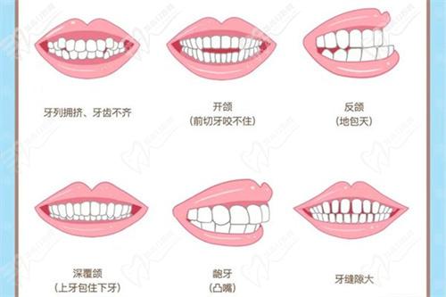 广州有名的正颌医生