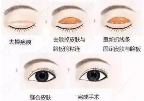 刘丽娜新疆整形医院怎么样