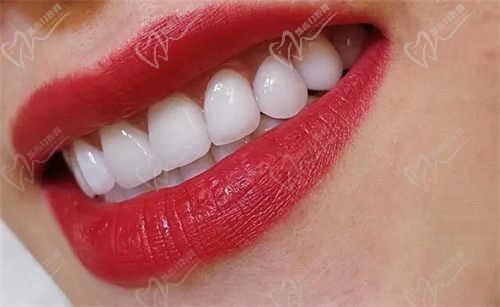 郑州桉康利口腔诊所特色项目及技术