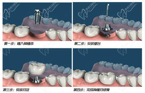 郑州桉康利口腔诊所口碑评价