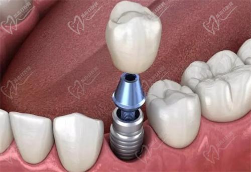 孔华锋口腔医生口碑评价