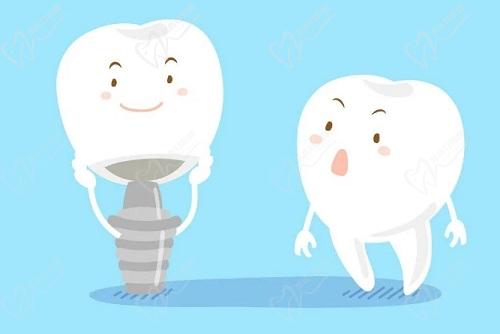 宁波艺星口腔医院孔华锋擅长项目