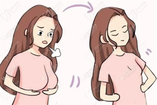 合肥维多利亚做缩胸好吗