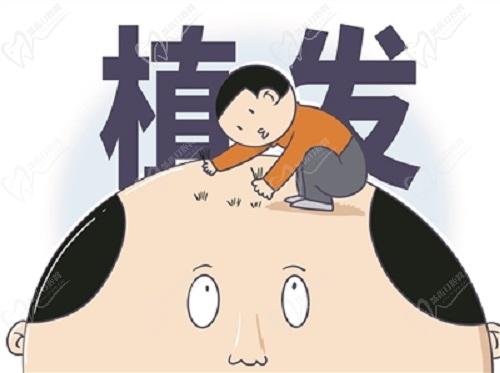 大连大麦微针植发医院张洪霞医生植发技术优势