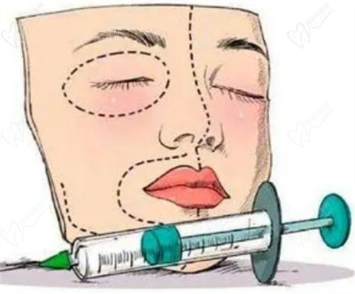 弗缦胶原蛋白多少钱一支