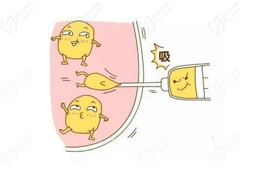成都怡脂医院邓萌医生怎么样