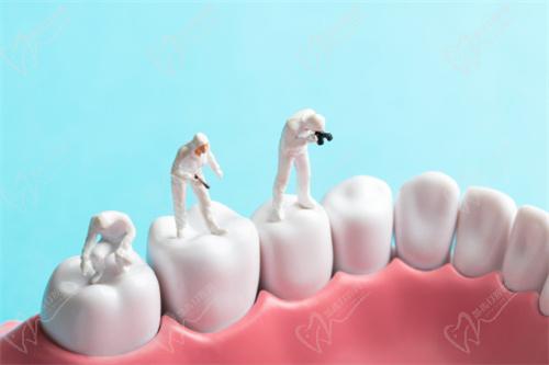 2025中老年人种牙价格表大全 2025中老年人种牙价格表大全