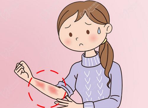 武汉同 济医院增生性瘢痕修复技术高端