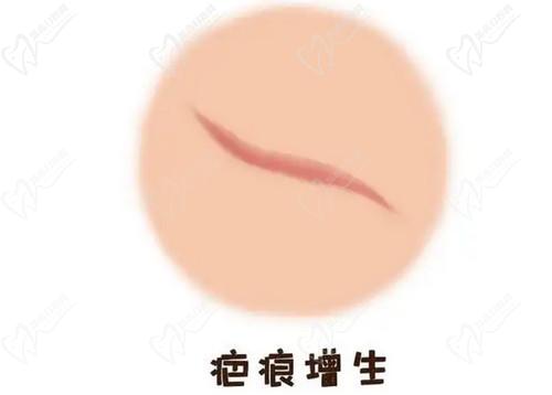 武汉同 济医院疤痕修复医生技术娴熟