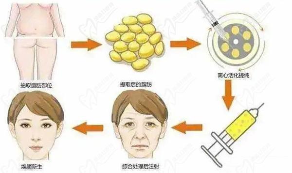 馒化脸修复