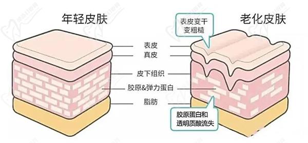 馒化脸修复