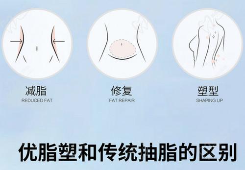 武汉同 济医院优脂塑抽脂技术扎实