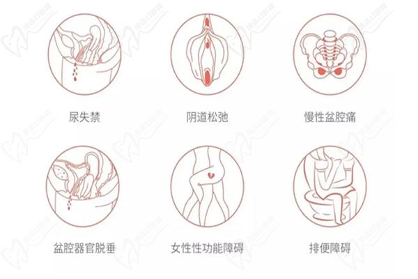 MEC 3D生物束带微创紧缩术的优势在于