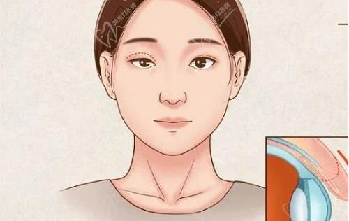 魏志香高难度眼睛修复怎么样
