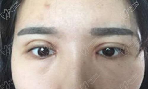 魏志香高难度眼睛修复怎么样